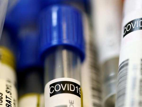 COVID Update @ Udaipur | Two Patients show strains of Coronavirus in repeat test