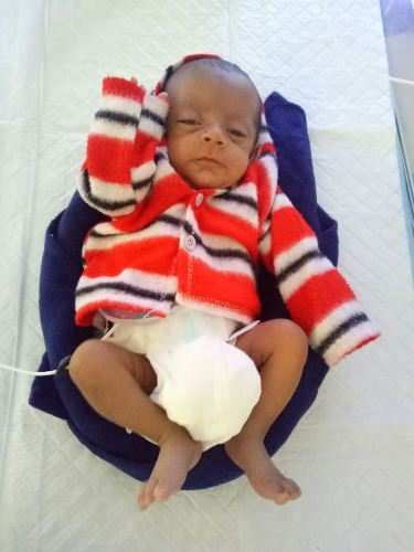 Miracle baby boy weighing 645gms survives major operation