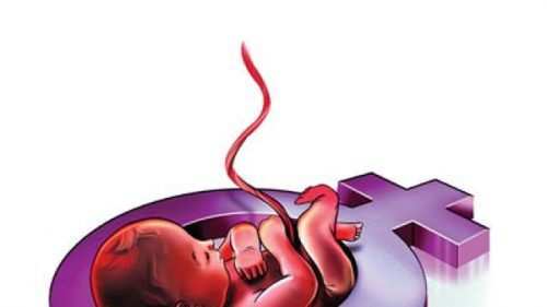 Udaipur Nurse arrested for carrying out sex determination test
