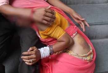 46-year-old Woman Thrashed by Group of Men