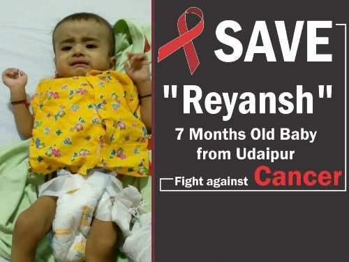 [UT4aCause] Help! Udaipur – 8 month old baby fighting Cancer