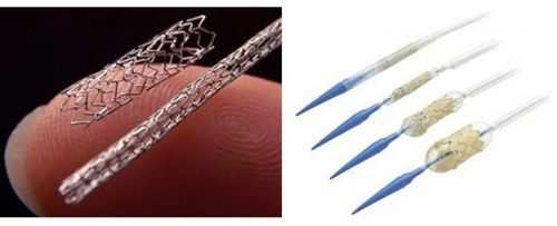 Stent – Prices fixed