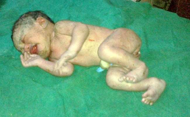 Parents abondon Infant girl in dustbin of MB Hospital