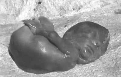 Female Fetus Found in Sewage