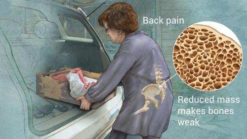 Zinc Deficiency… a reason behind Osteoporosis