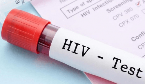 RNT medical college to get HIV testing facility