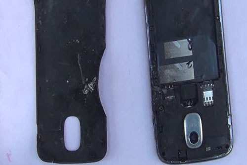 Mobile battery blasts, injures school boy
