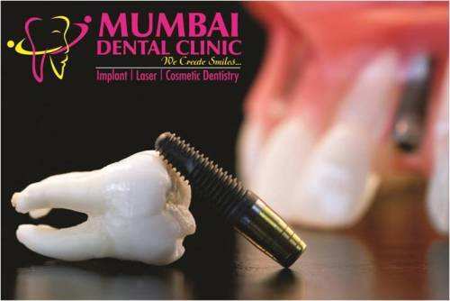 New Era of Dentistry Begins in City Of Lakes – Udaipur