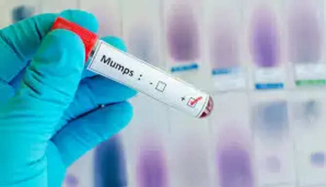 Mumps Cases