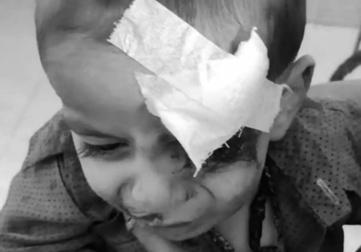 stray dog terror in Udaipur