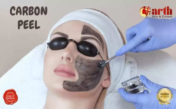 Carbon Peel Skin Treatment Arth Skin Treatment in Udaipur