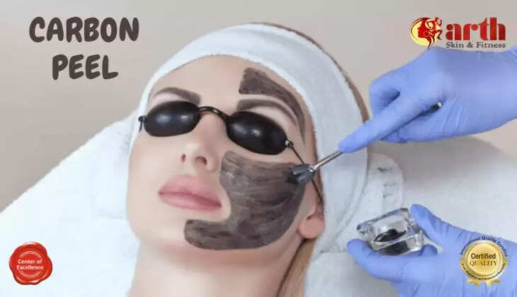 Carbon Peel Skin Treatment Arth Skin Treatment in Udaipur