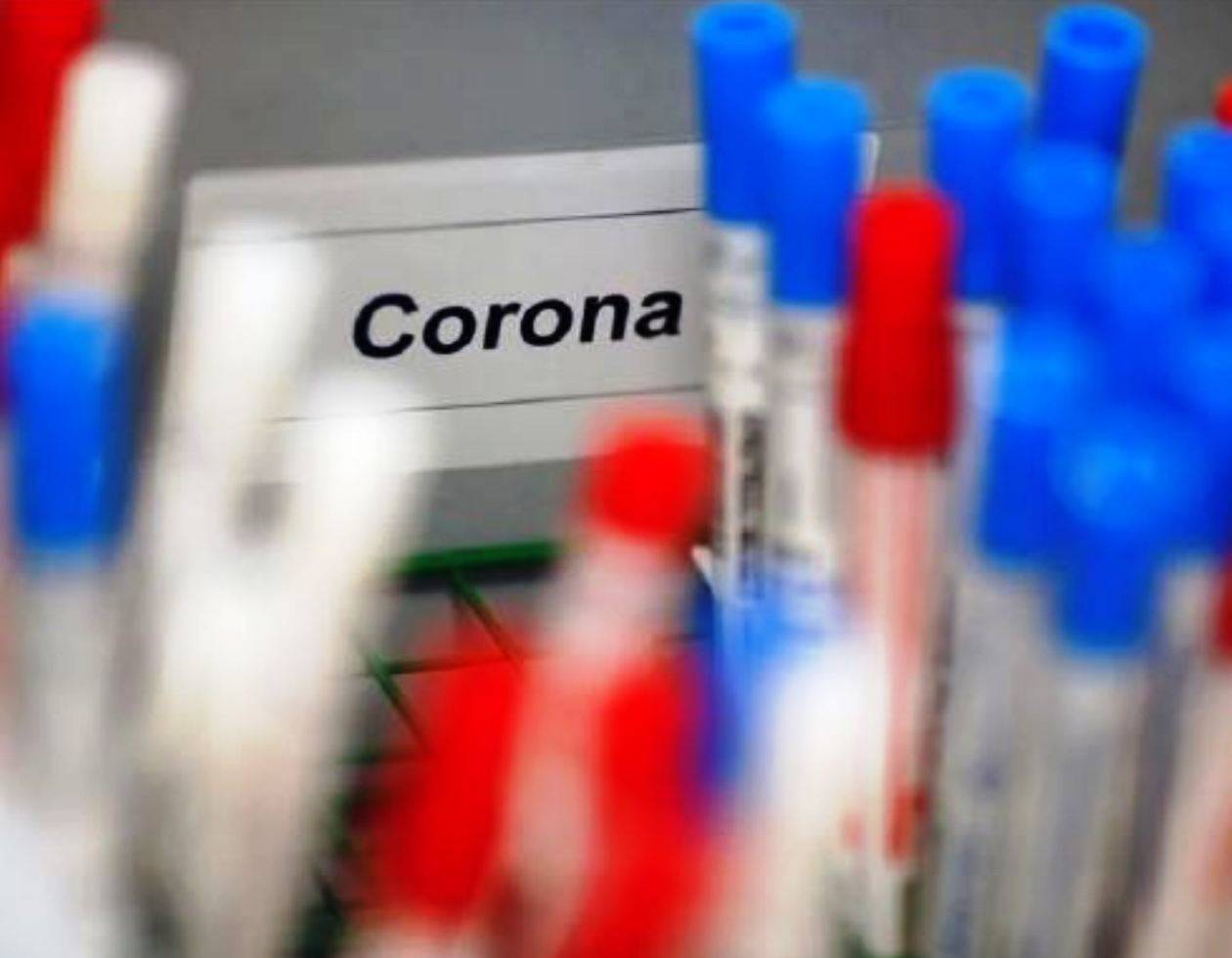 कोरोना अपडेट 7-10-2020: कोरोना का कहर जारी, आज 126 पॉजिटिव मिले
