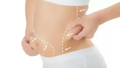 lose fat without surgery fat loss in udaipur fat loss clinic in udaipur alma technology laser arth skin and fitness