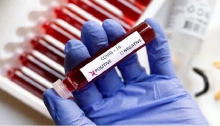 उदयपुर में कोरोना पॉजिटिव की संख्या 354 पहुंची