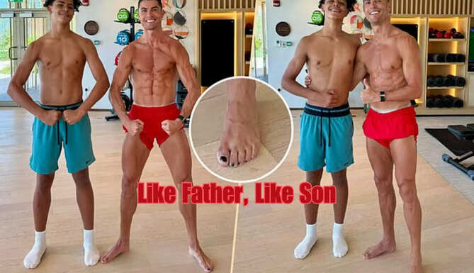 Cristiano Ronaldo nail polish, Ronaldo black toenails, footballer grooming habits, Ronaldo foot care, athlete wellness routine, Ronaldo fitness secret