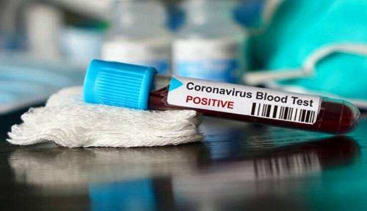 उदयपुर में गुरुवार को 5 कोरोना पॉजिटिव मिले