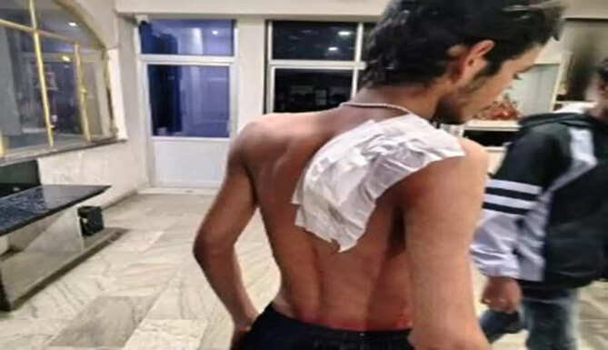 man attacked at tea shop
