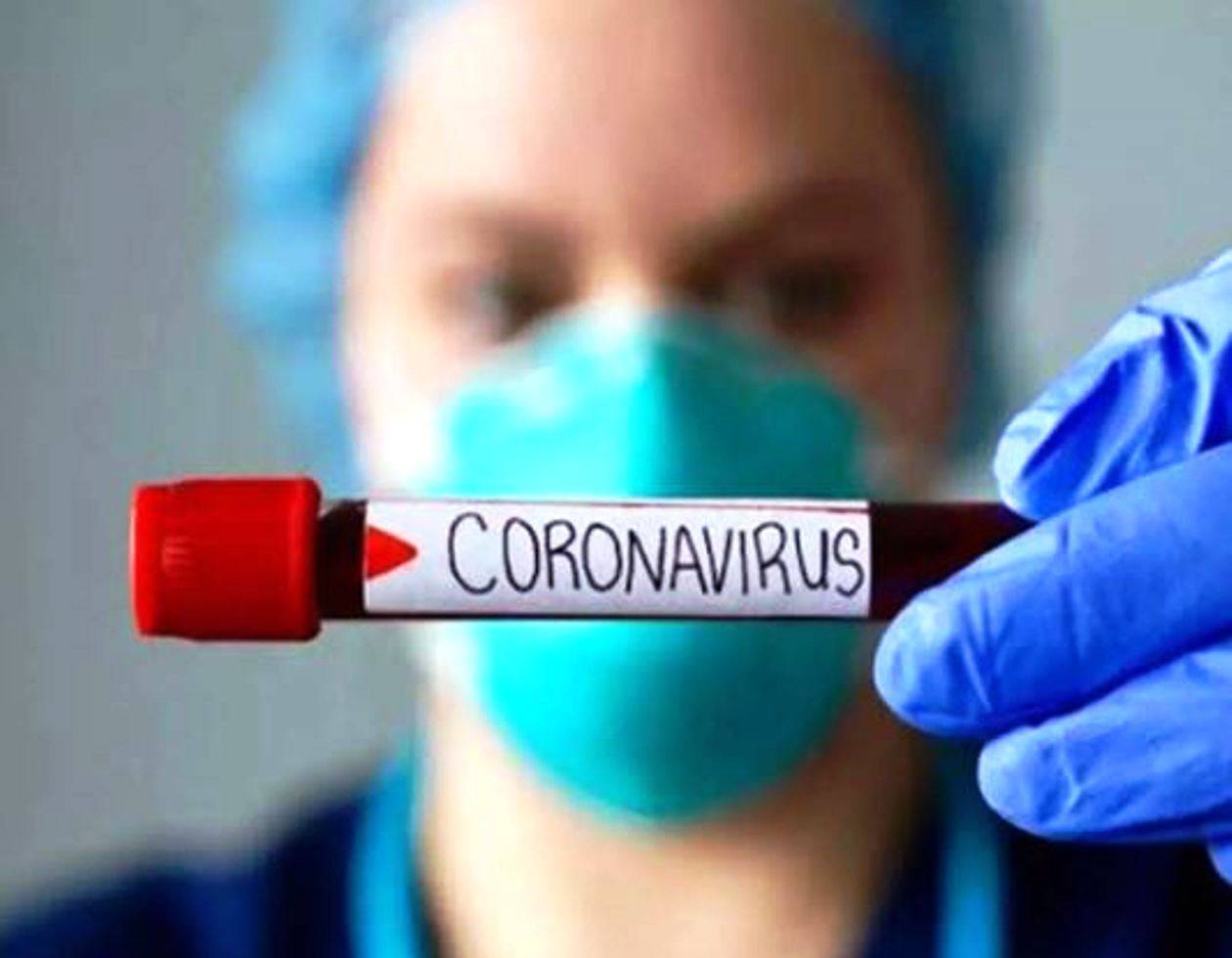 सरकारी हॉस्पिटल में कोरोना की जांच निशुल्क जबकि प्राइवेट में 1200 रु में