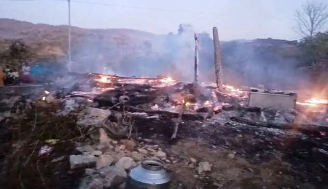 child burn in fire