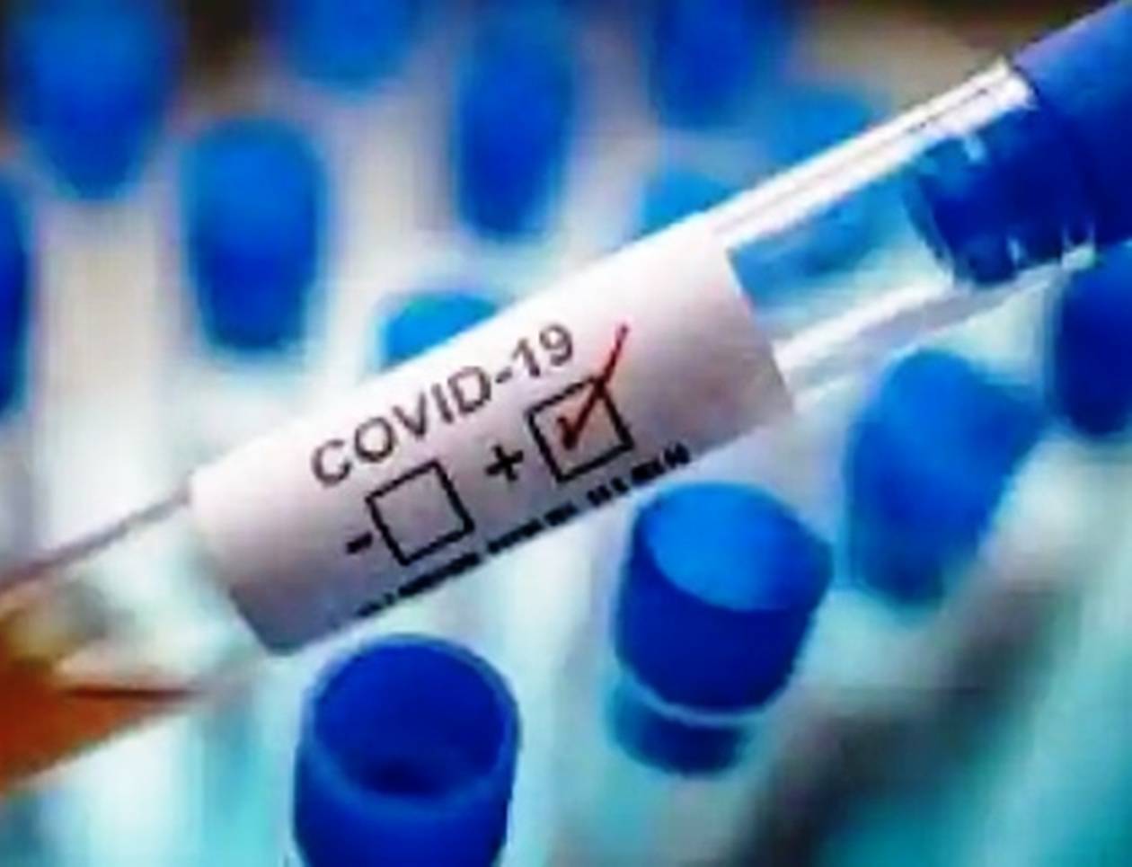 उदयपुर में जल्द कोरोना वैक्सीन आने की संभावना, तैयारियां हुई तेज