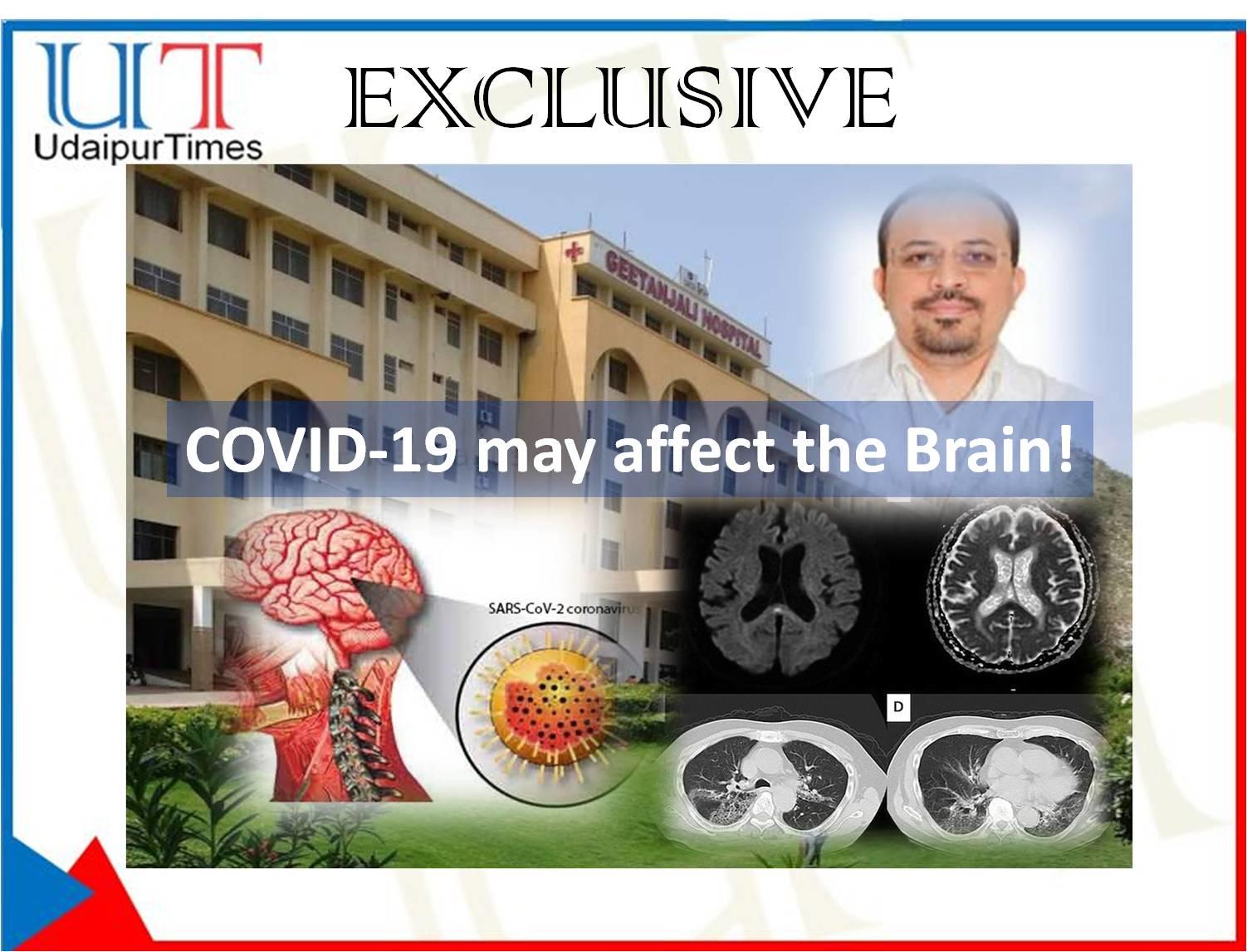 Rare case of COVID Encephalitis at Udaipur | GMCH treats 30 year old COVID patient successfully