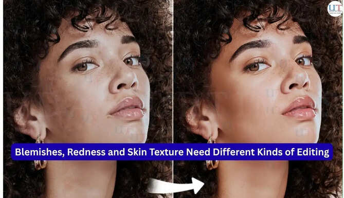 Blemishes, Redness and Skin Texture Need Different Kinds of Editing