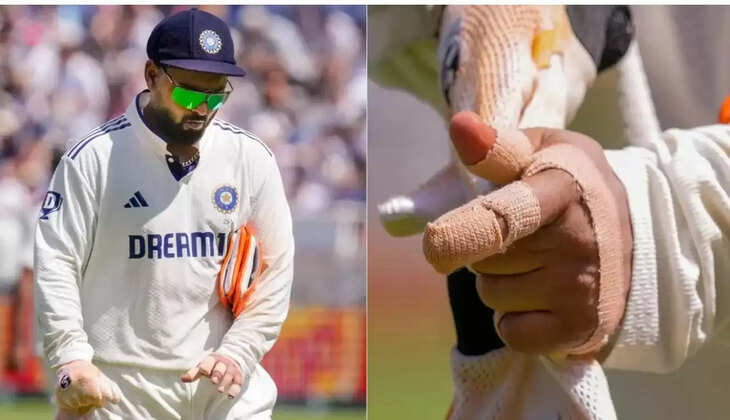 -Rishabh Pant injury, Team India update, India vs England Test, Rishabh Pant fitness, Indian cricket news, Pant second day absence, Indian team concern, England Test 2025