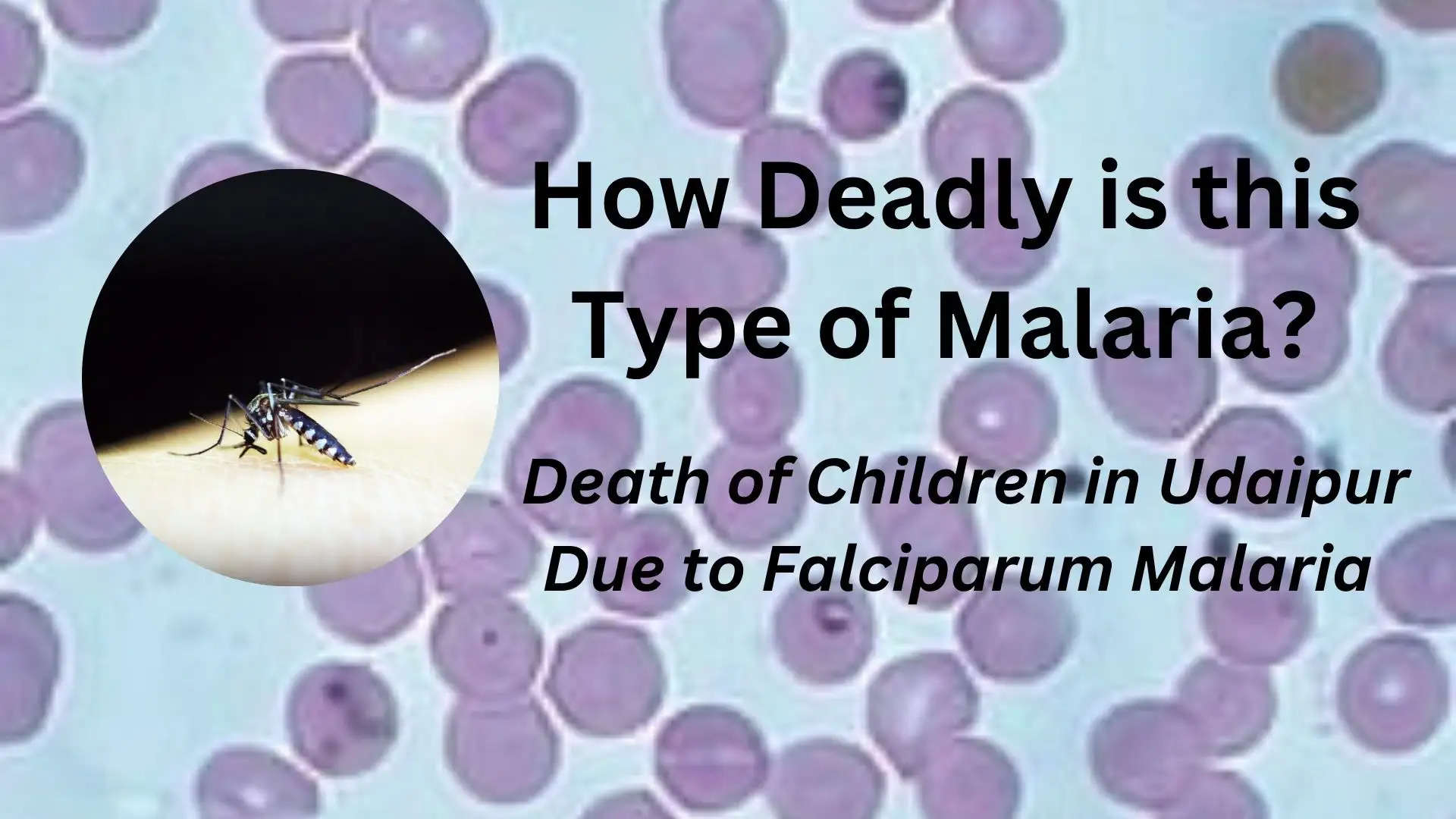 Falciparum Malaria