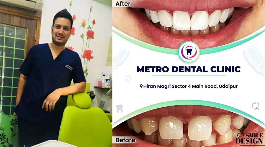 dental health in udaipur metro dental clinic dentists in udaipur