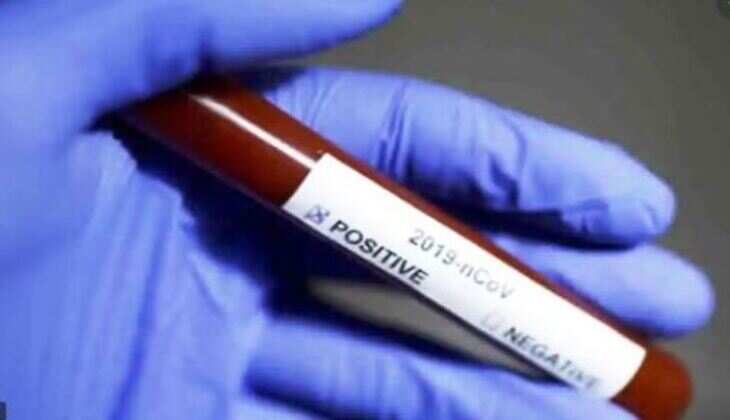 उदयपुर में आज सुबह तक मिले 13 नए कोरोना मरीज
