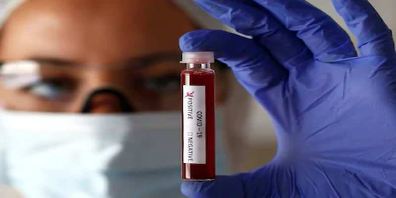 उदयपुर में कोरोना संक्रमितों की संख्या पहुंची 127